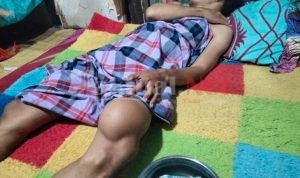 Derita Kanker Lutut 9 Tahun, Sultan Butuh Uluran Tangan Untuk Berobat