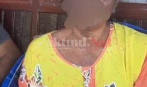 Diduga Gegara Konsumsi Obat Dari PKM Bontomatene, Tubuh IRT Di Jeneponto Dipenuhi Bintik Hitam