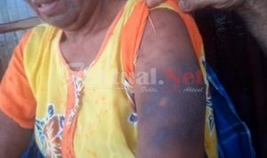 Diduga Oknum Perawat PKM Bontomatene Yang Beri Obat, Wajah Dan Tubuh Pasien Dipenuhi Bintik Hitam