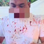 Diduga Telah Terjadi Pengeroyokan Terhadap Anggota Polisi di Banten