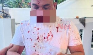 Diduga Telah Terjadi Pengeroyokan Terhadap Anggota Polisi di Banten
