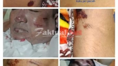 Komnas HAM Rekomendasikan Investigasi Lanjutan Ke Mabes Polri Atas Kasus Kematian Almarhum Kaharuddin Daeng Sibali. 