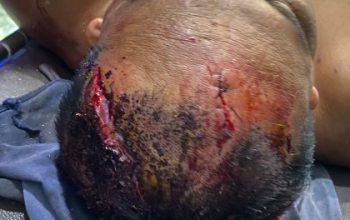 Ali Murdani Manurung Diborgol dalam Kondisi Luka Parah, Kuasa Hukum: “Ini Sudah Melampaui Batas”