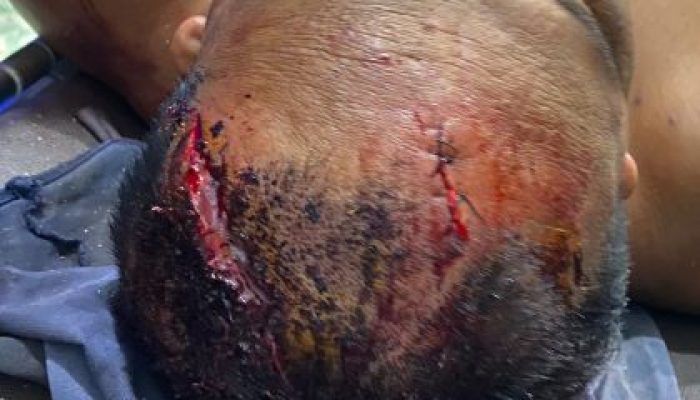 Ali Murdani Manurung Diborgol dalam Kondisi Luka Parah, Kuasa Hukum: “Ini Sudah Melampaui Batas”