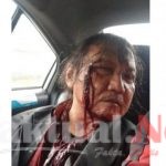 Sadis, Lagi-lagi Penganiayaan pada Wartawan Saat Bertugas