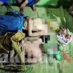 Dua Warga Pandeglang Tewas Tersambar Petir